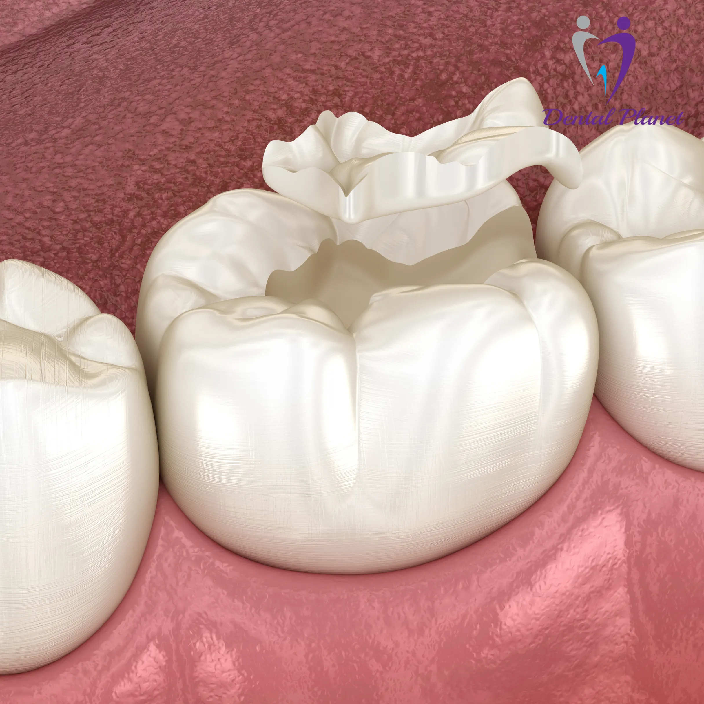 Best Dentist in Mysore