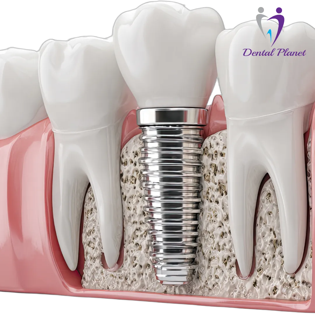 Best Dentist in Mysore