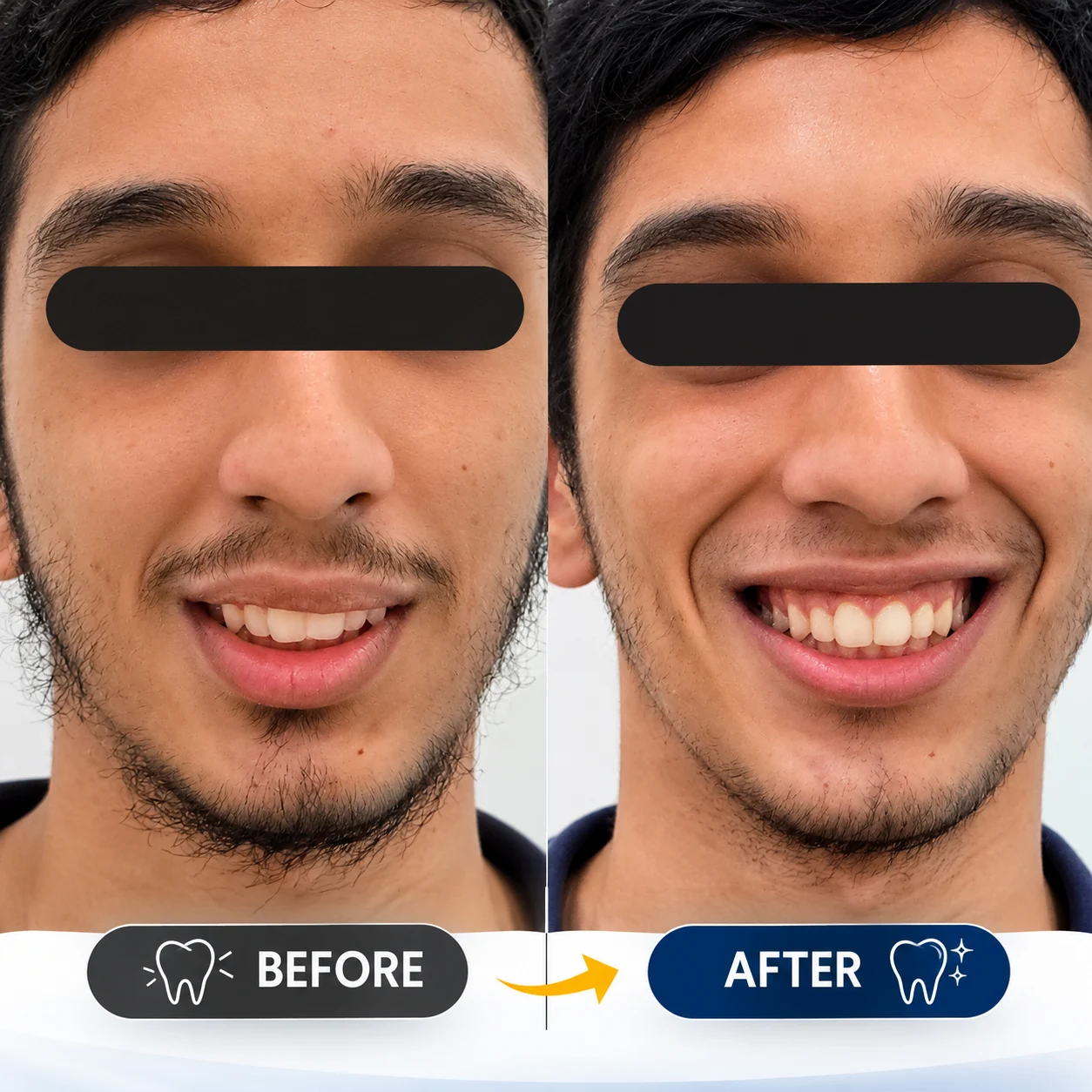 Before After Case 1