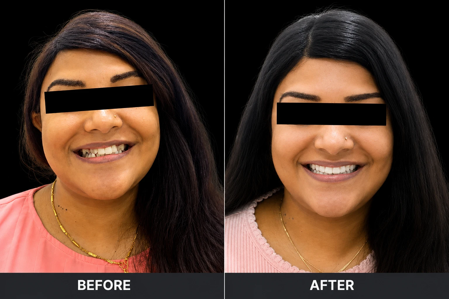 Before After Case 2
