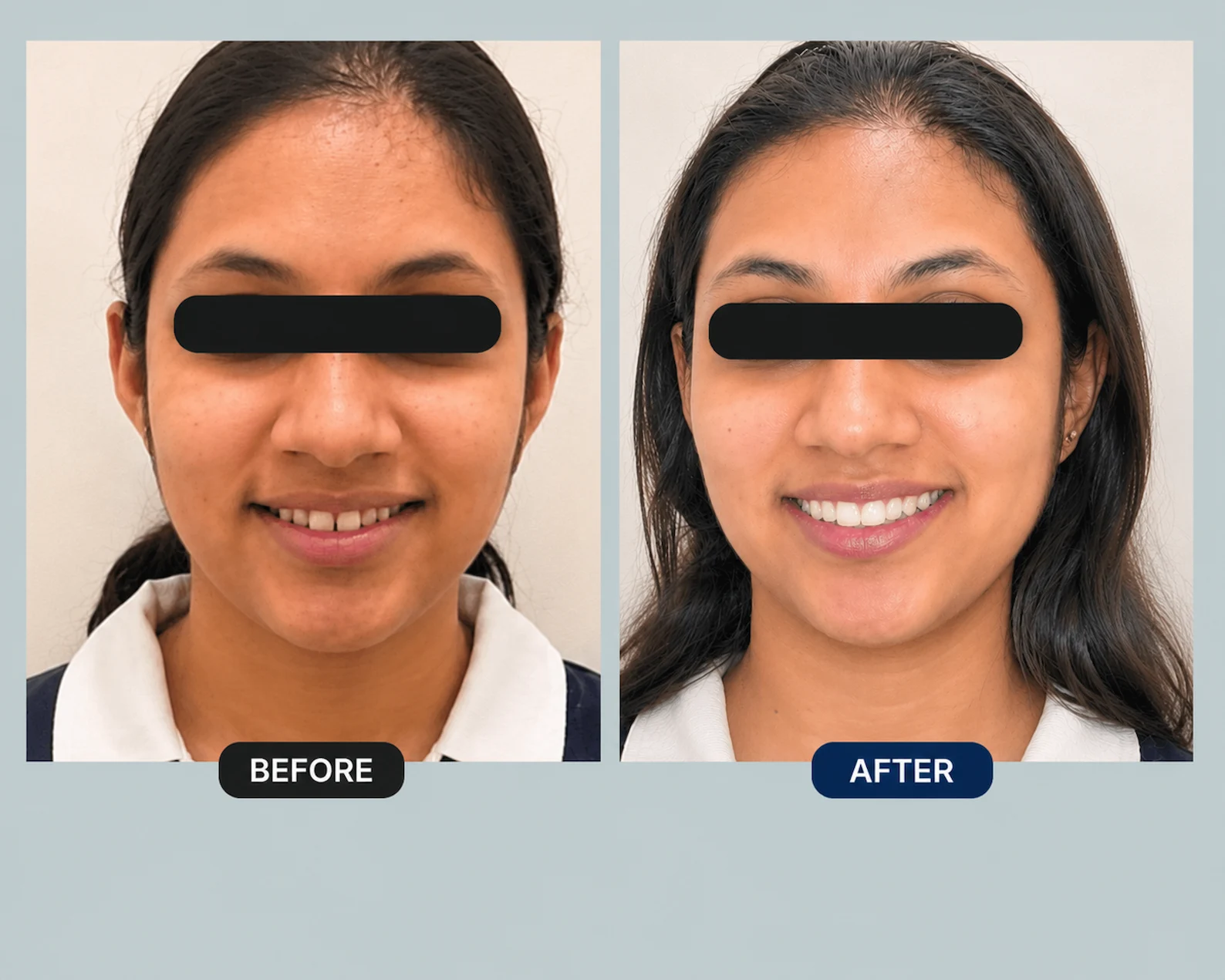 Before After Case 3