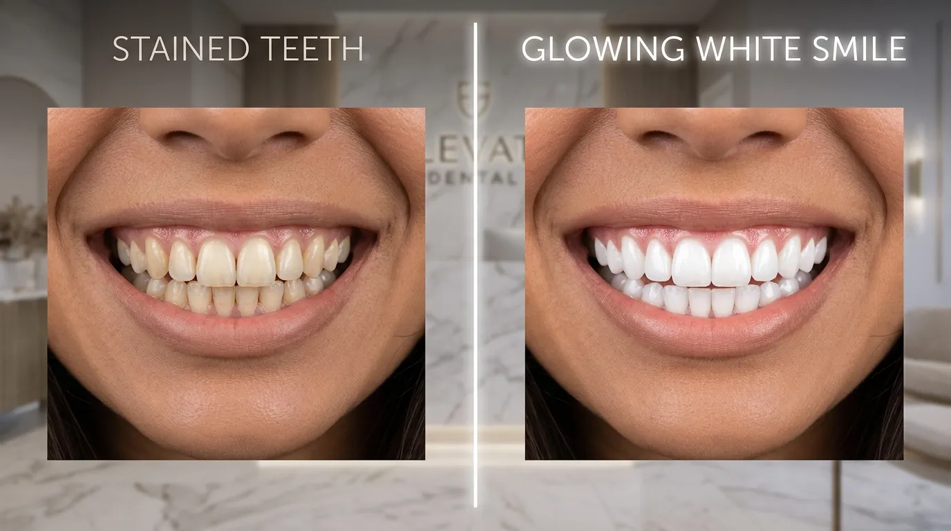 Teeth Whitening Mysore